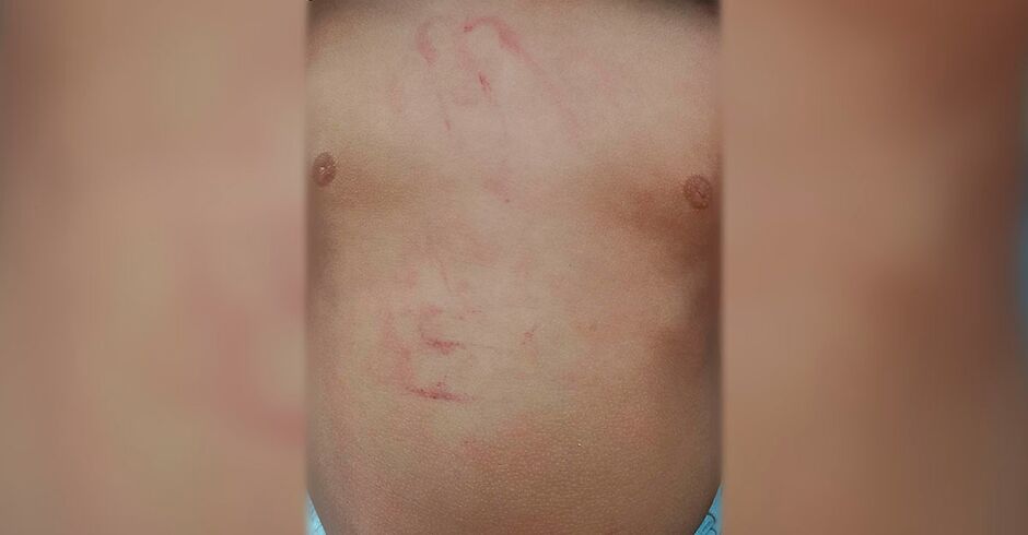 Babá disse a mãe que menino havia caído nos brinquedos, mas marcas de dedos foram encontradas no corpo do menino