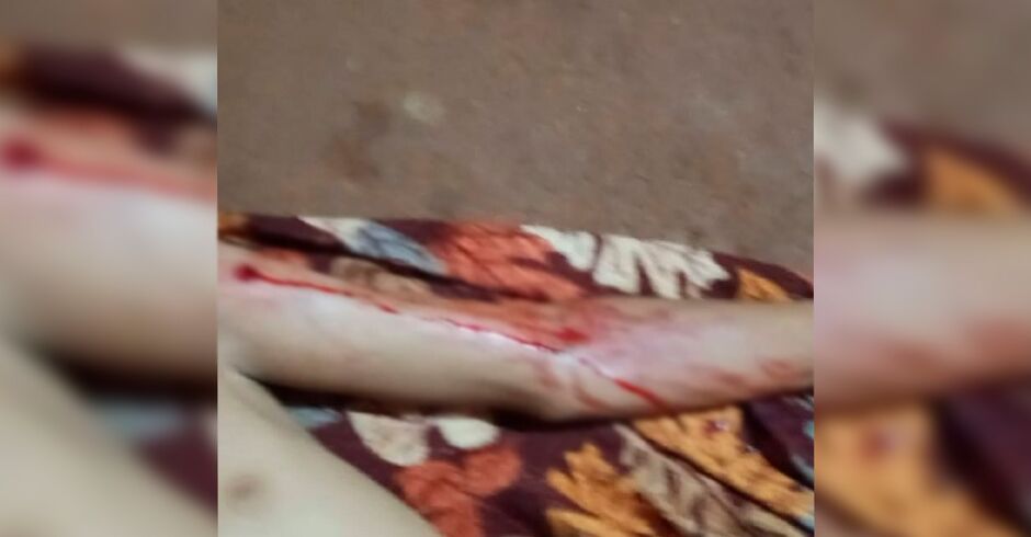 Indígena é morte durante ataque em área de retomada