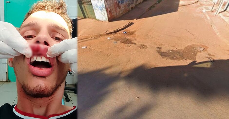 Homem é agredido após desentendimento no trânsito