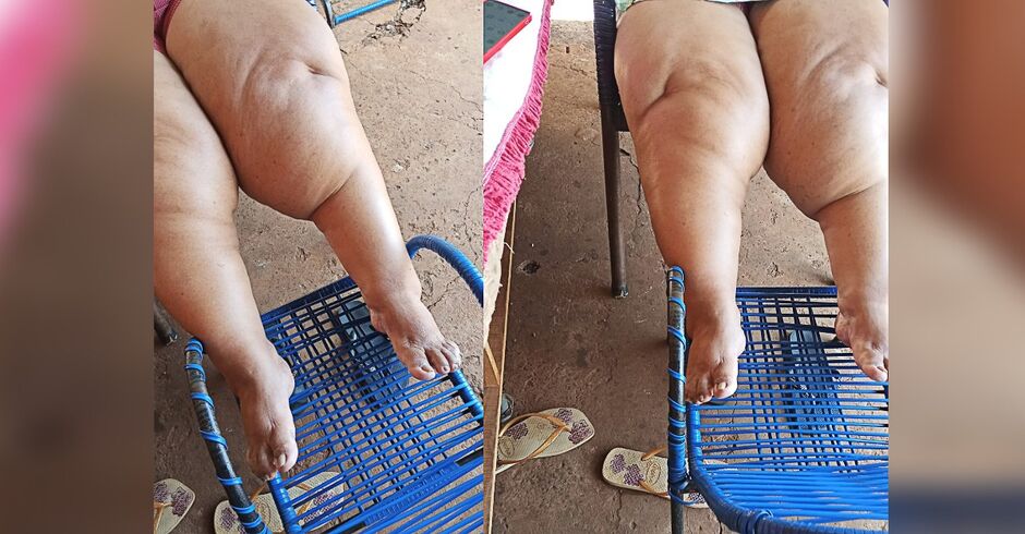 Sem atendimento e conseguir trabalhar mulher viv da ajuda dos amigos e familiares