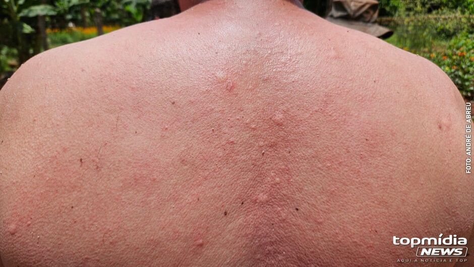 Idoso é atacado por enxame de abelhas em quintal de casa