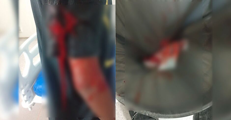 Mãe fica preocupada após cirurgia indevida