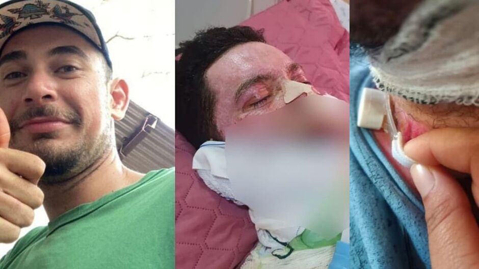 Geovane segue em recuperação com ajuda da esposa