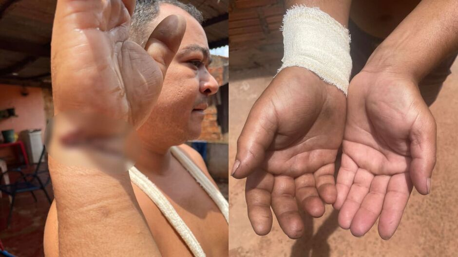 Diego precisa passar por cirurgia para recuperar movimentos e voltar ao trabalho 