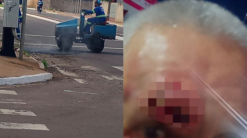Idoso s&oacute; precisou 'quebrar a cara' em buraco para prefeitura tampar buraco na J&uacute;lio de Castilho