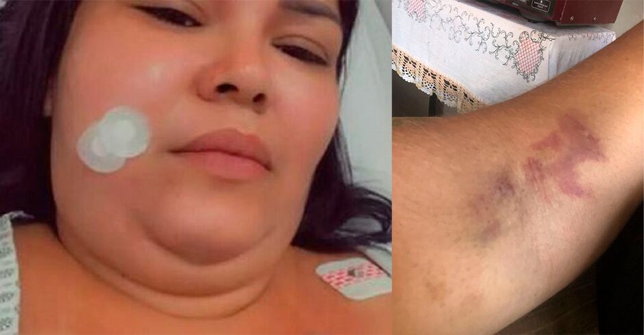 Sem conseguir mais suportar as ores, mulher pede ajuda para realizar os procedimentos necess&aacute;rios,