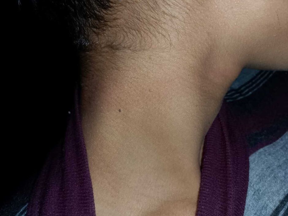 Adolescente de 16 anos sofre tentativa de estrangulamento e foge para escapar do namorado 