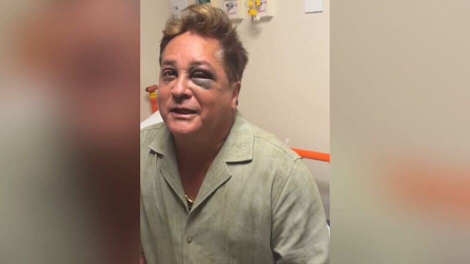 Cantor diz que machucou o ''chifre''