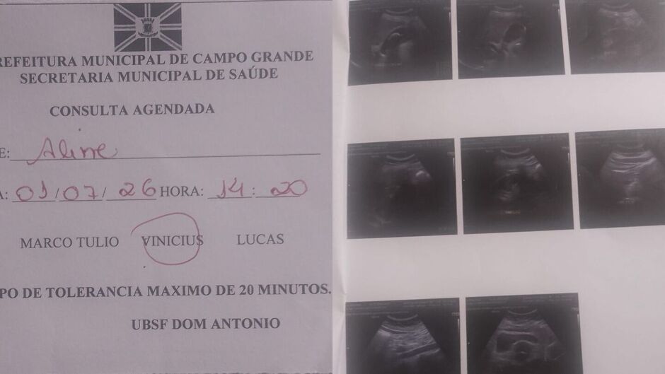 Com dores intensas, mulher aguarda at&eacute; julho por consulta e cirurgia em Campo Grande